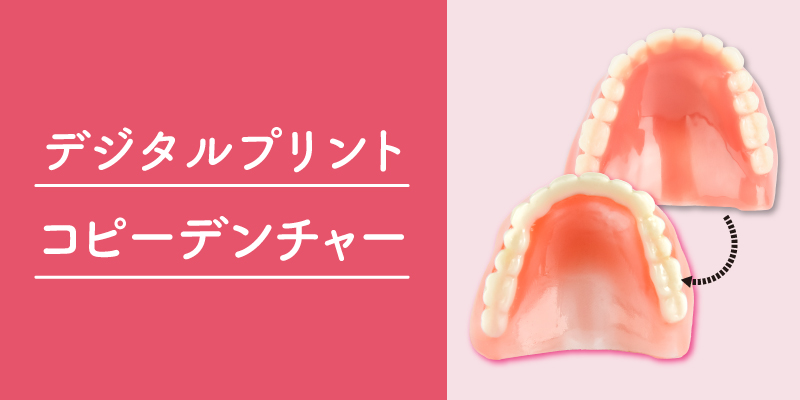 デジタルプリントコピーデンチャー